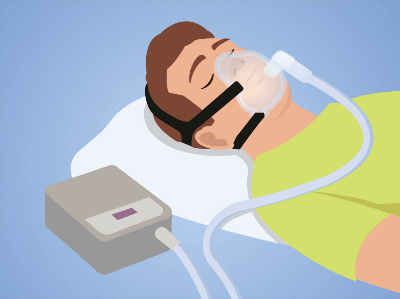 Hulpmiddelen tegen snurken: CPAP-masker