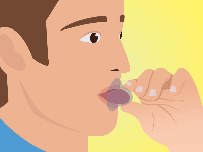 Hulpmiddelen tegen snurken: tongstabilisator